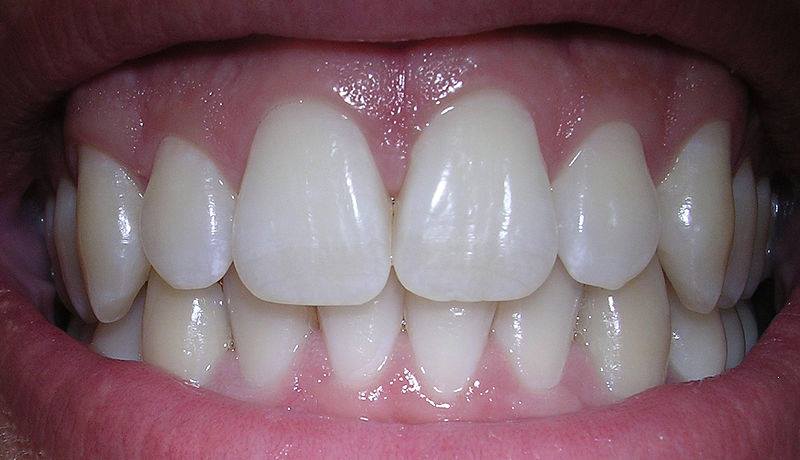 Фотография зубов человека